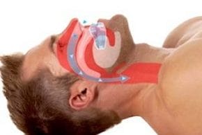 SnoreMeds Availability and Warranty