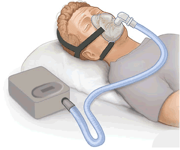 cpap equipment sketch cpap equipment sketch