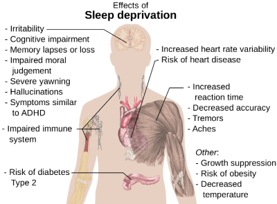 sleep deprivation chart