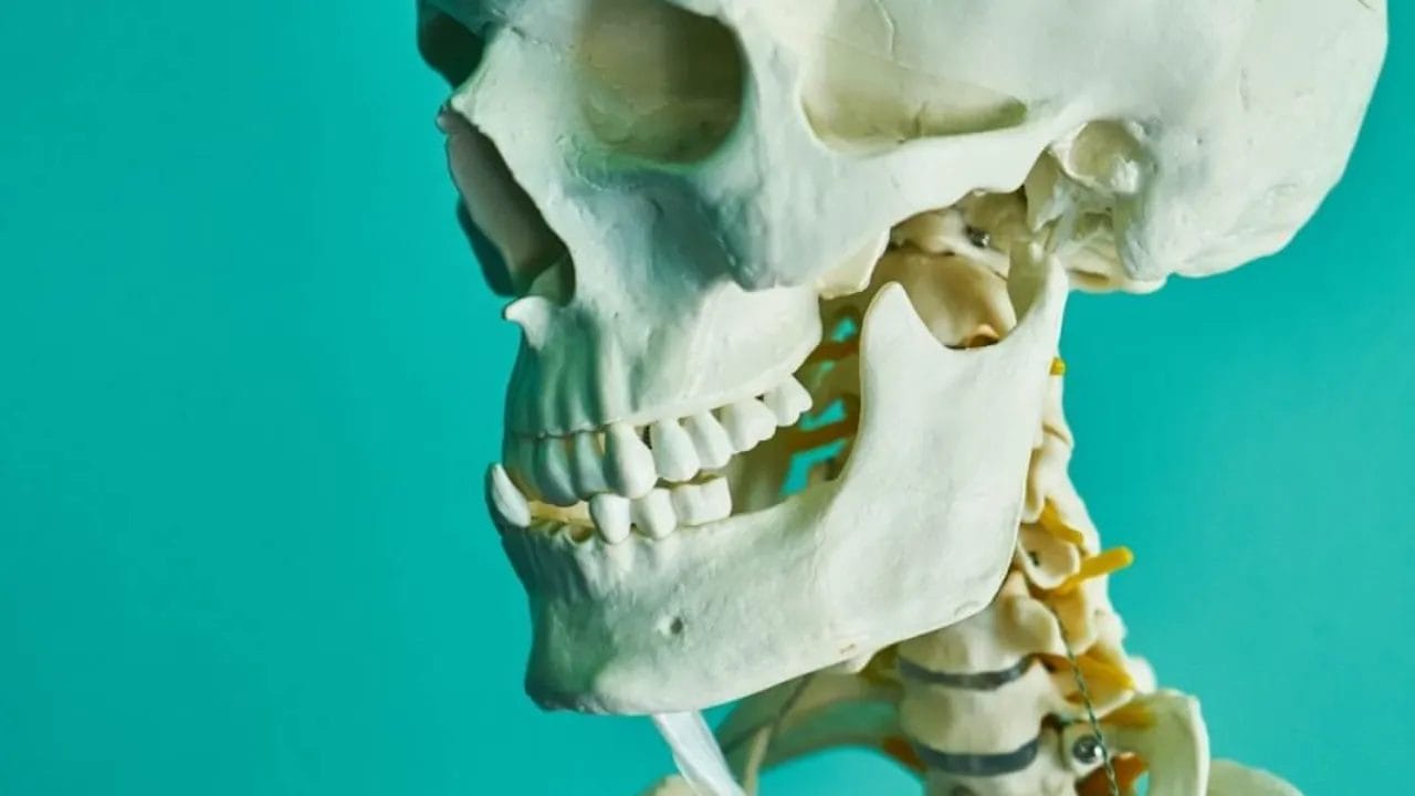 Adjustable Mandibular Advancement Device